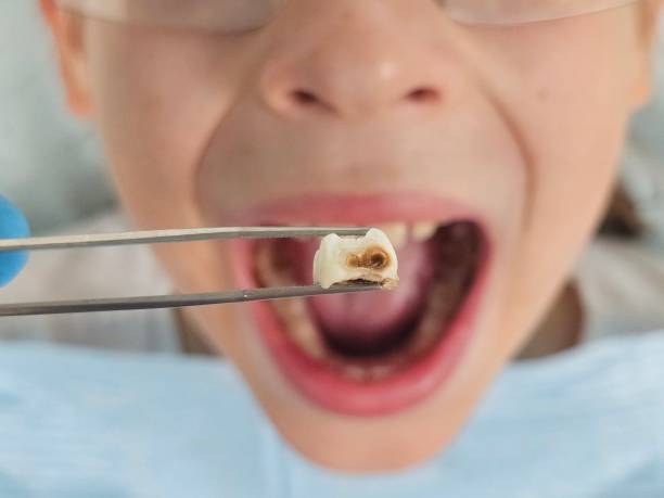 Best Emergency Gum Treatment in Southlake, TX